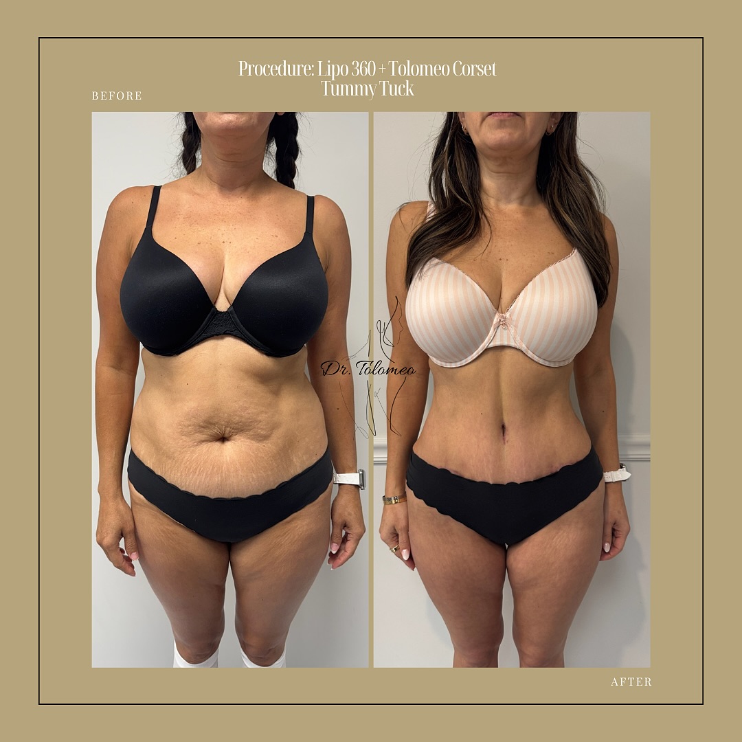 Dr. Tolomeo's Instagram Post - 8