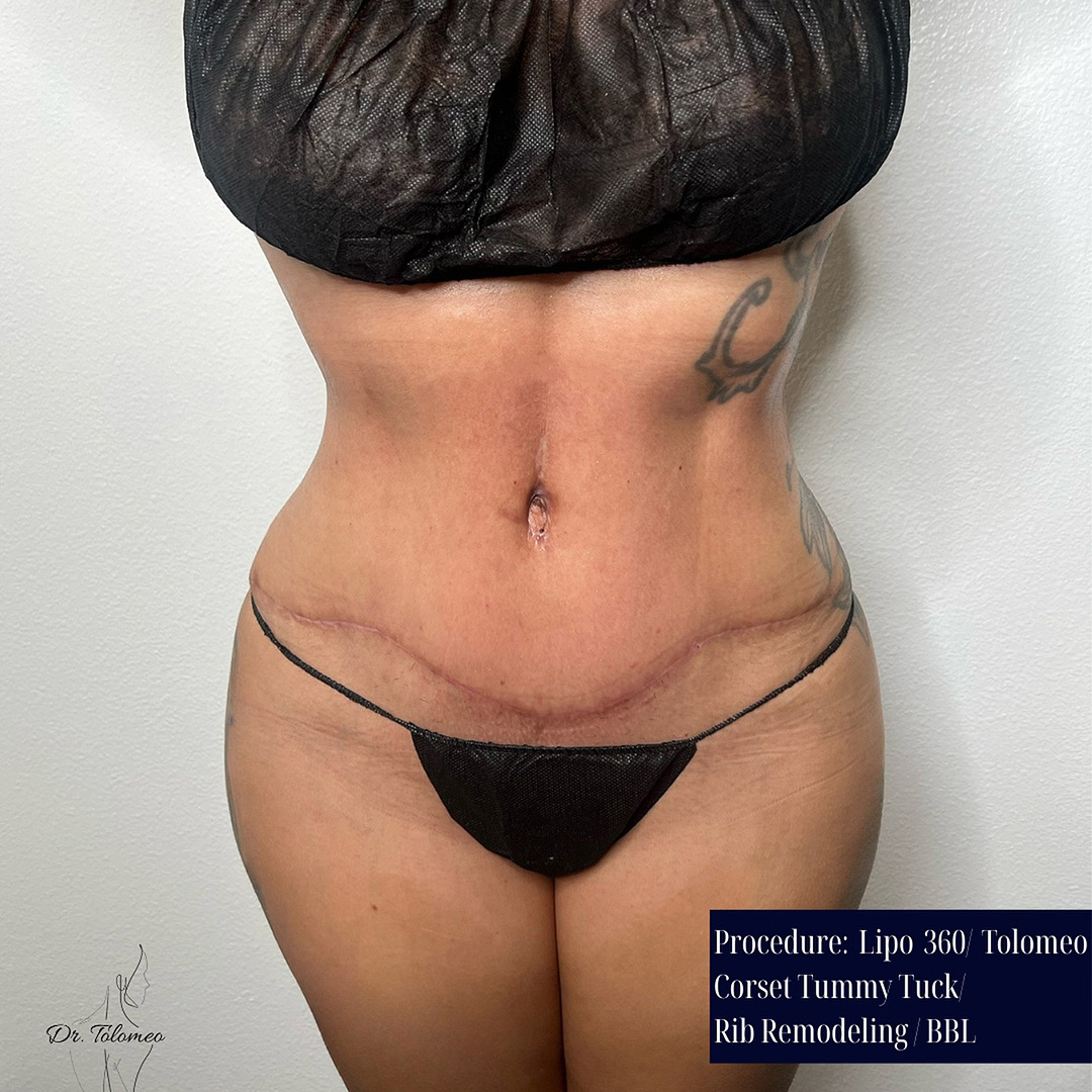 Dr. Tolomeo's Instagram Post - 5