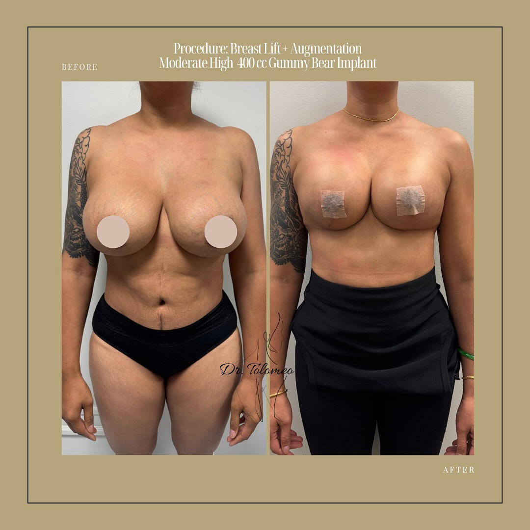 Dr. Tolomeo's Instagram Post - 6