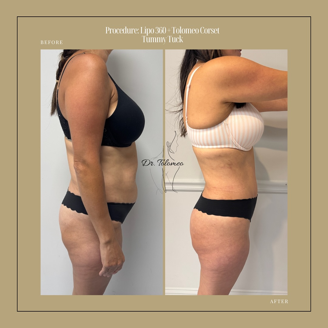 Dr. Tolomeo's Instagram Post - 7