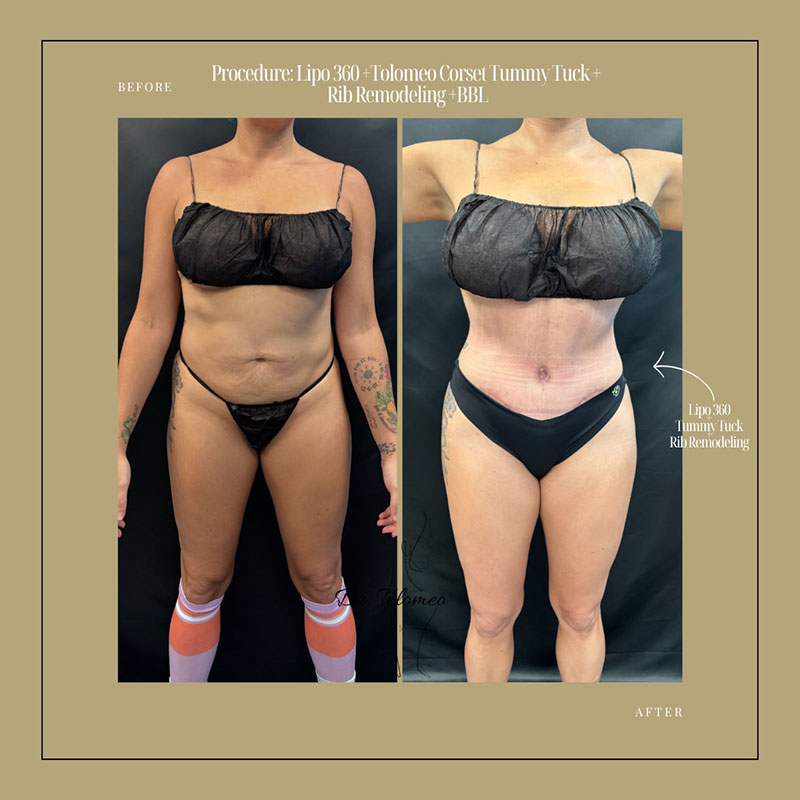 Dr. Tolomeo's Instagram Post - 7