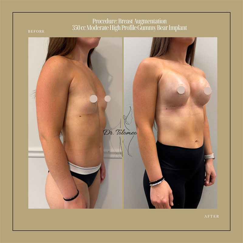 Dr. Tolomeo's Instagram Post - 8