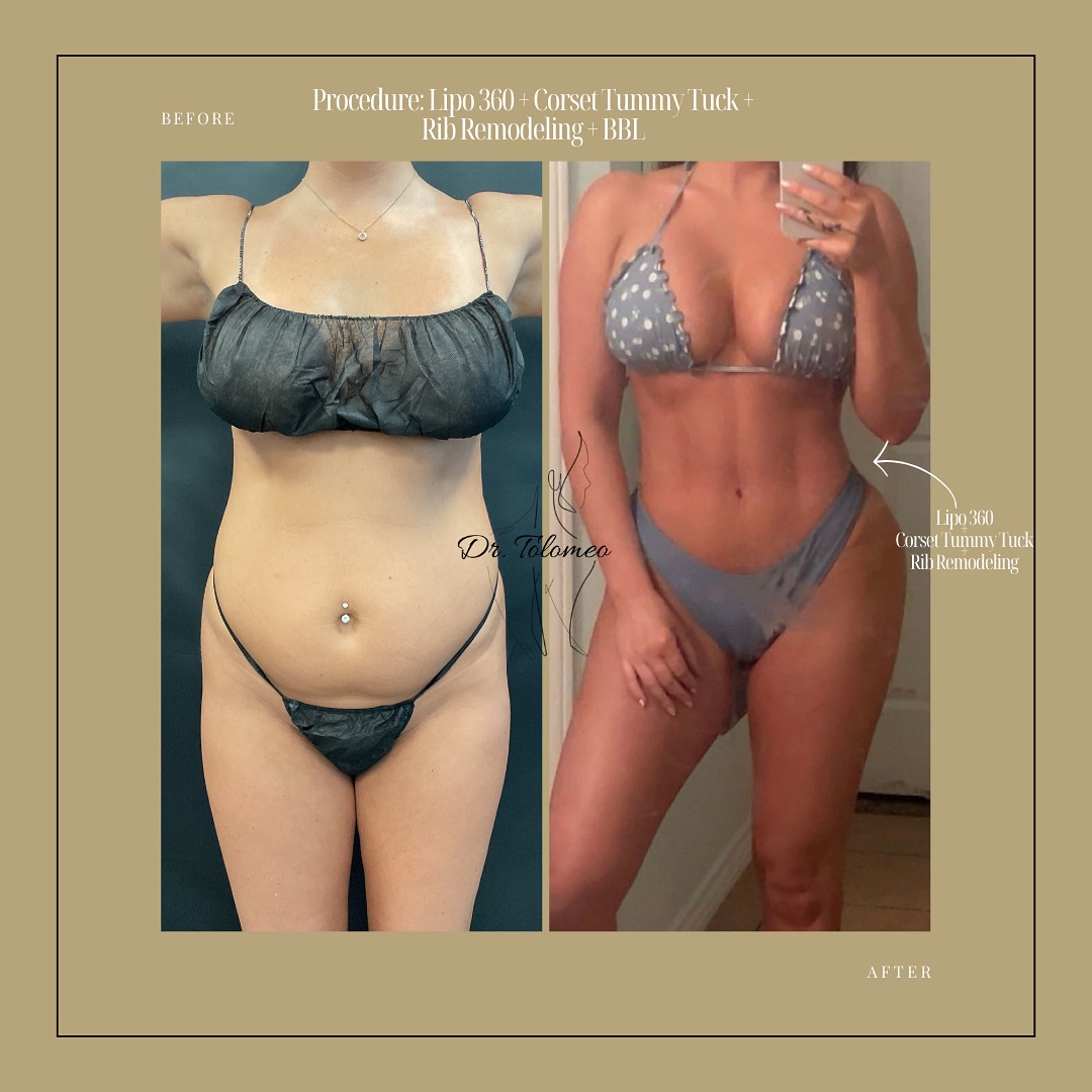 Dr. Tolomeo's Instagram Post - 6