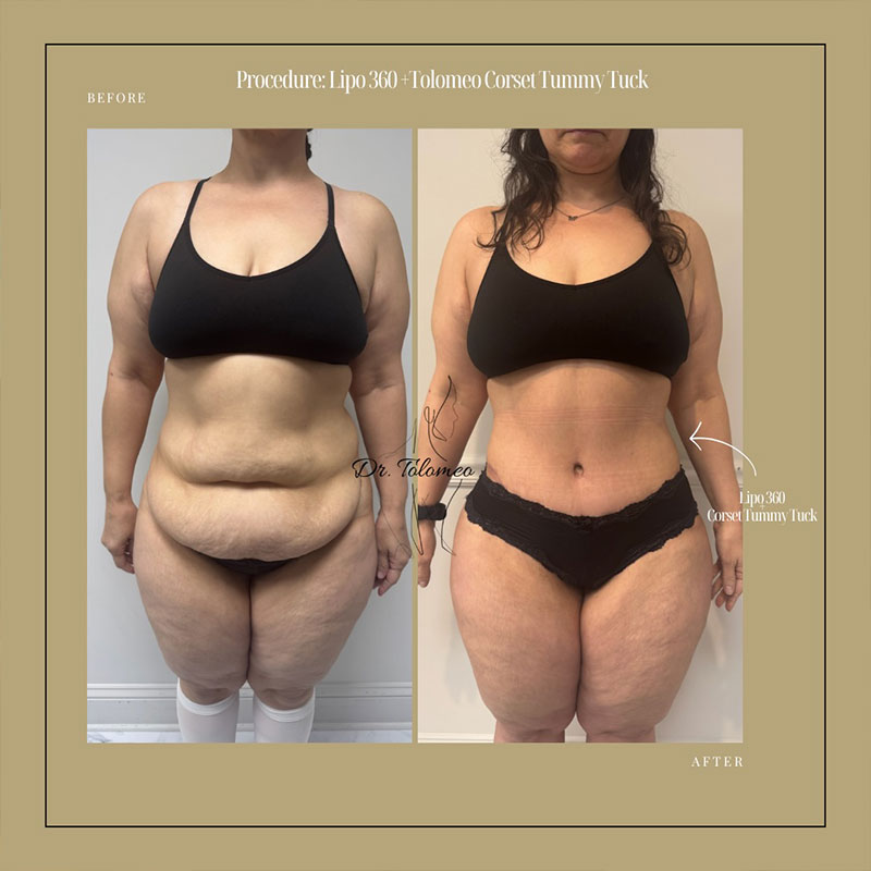 Dr. Tolomeo's Instagram Post - 5