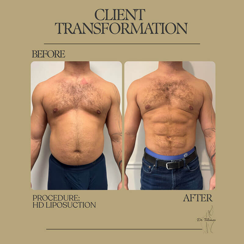 Dr. Tolomeo's Instagram Post - 7