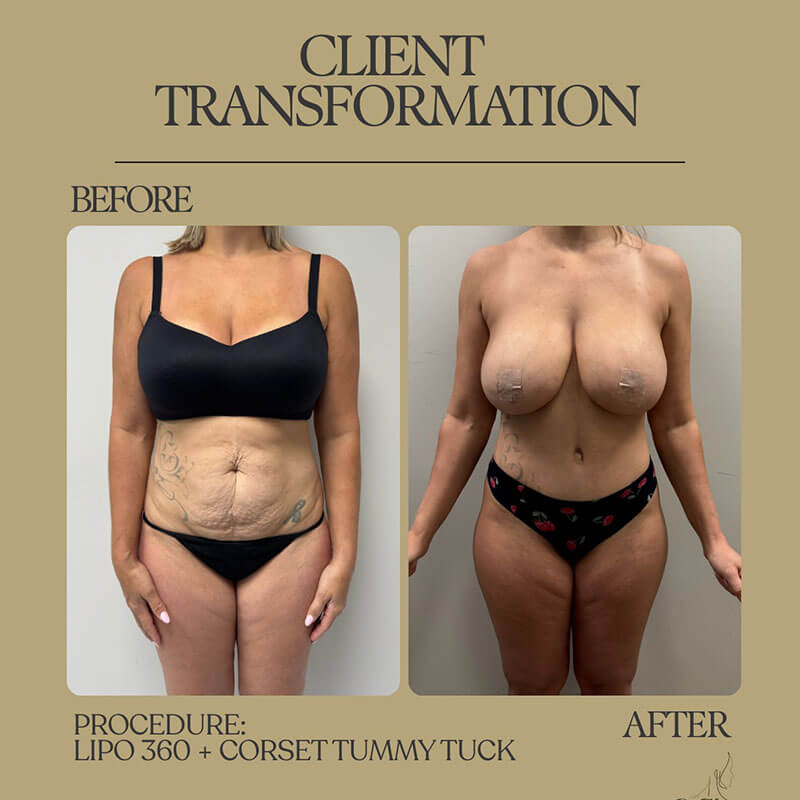 Dr. Tolomeo's Instagram Post - 6