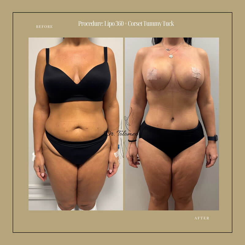 Dr. Tolomeo's Instagram Post - 8