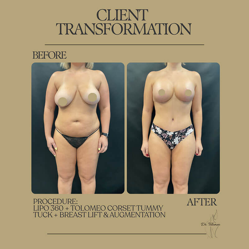 Dr. Tolomeo's Instagram Post - 8